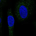Atlas Antibodies Anti-SNX24 Antibody