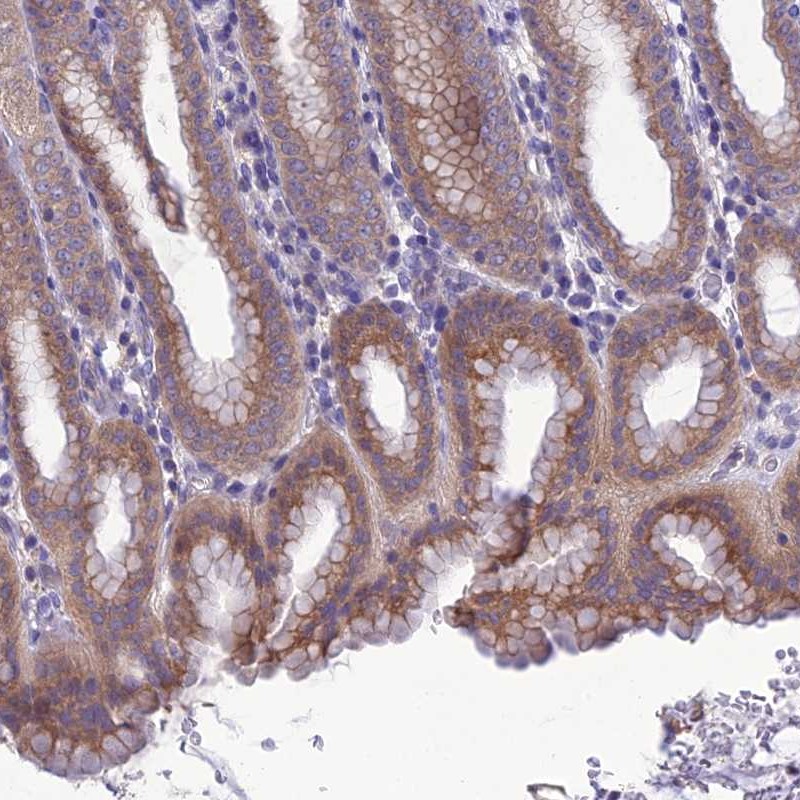Atlas Antibodies Anti-SNX24 Antibody