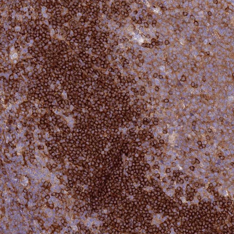 Atlas Antibodies Anti-SNX21 Antibody