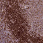 Atlas Antibodies Anti-SNX21 Antibody