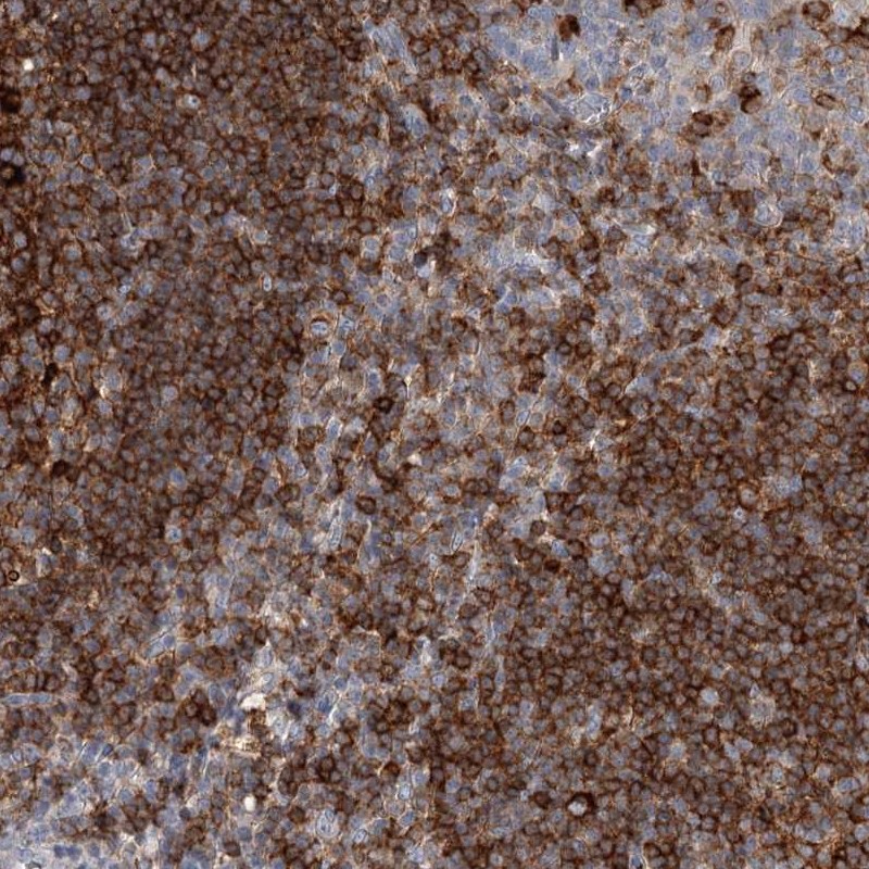 Atlas Antibodies Anti-SNX22 Antibody