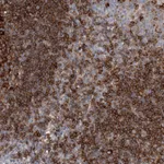 Atlas Antibodies Anti-SNX22 Antibody
