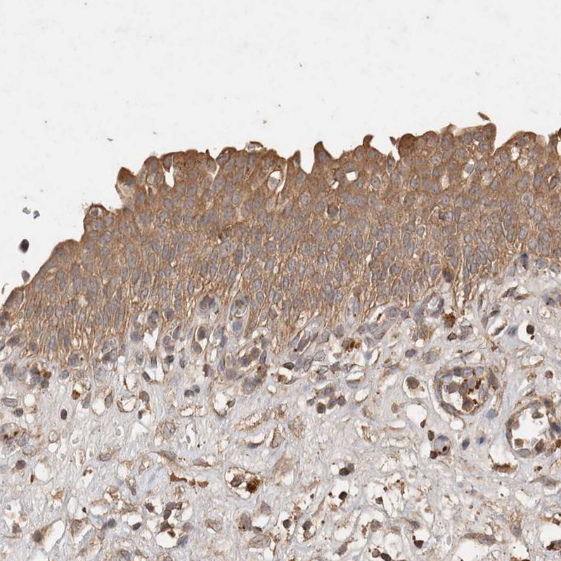 Atlas Antibodies Anti-SNX31 Antibody