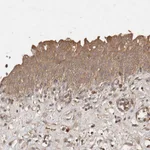Atlas Antibodies Anti-SNX31 Antibody