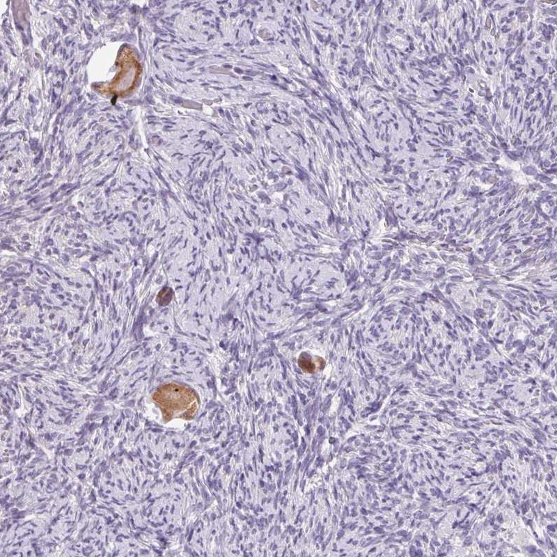 Atlas Antibodies Anti-SNX31 Antibody
