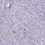 Atlas Antibodies Anti-SNX31 Antibody