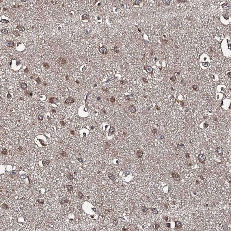 Atlas Antibodies Anti-SNX32 Antibody