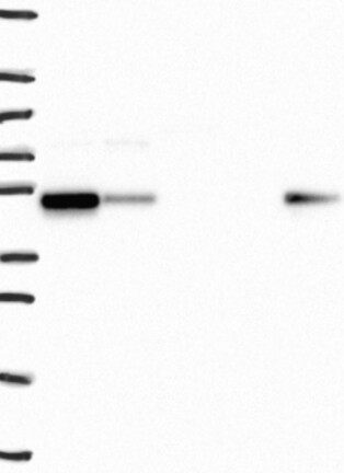 Atlas Antibodies Anti-SNX5 Antibody