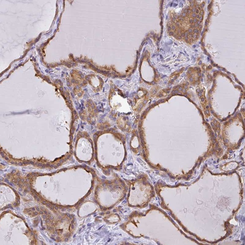 Atlas Antibodies Anti-SNX5 Antibody
