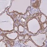 Atlas Antibodies Anti-SNX5 Antibody
