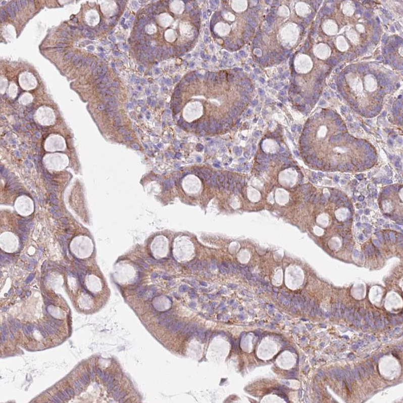 Atlas Antibodies Anti-SNX6 Antibody