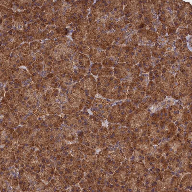 Atlas Antibodies Anti-SNX33 Antibody