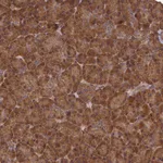 Atlas Antibodies Anti-SNX33 Antibody