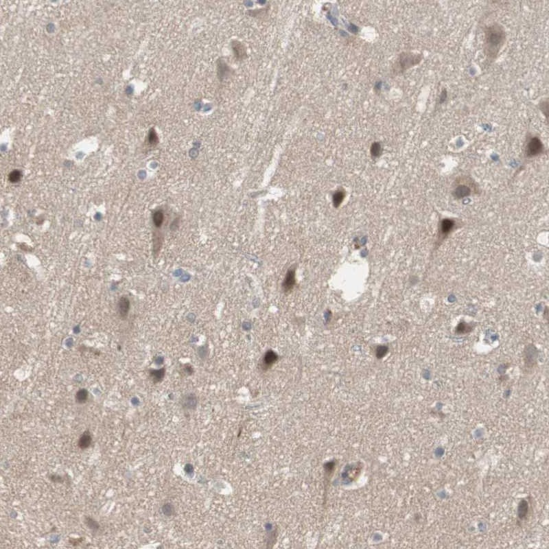 Atlas Antibodies Anti-SNX4 Antibody
