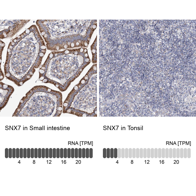 Atlas Antibodies Anti-SNX7 Antibody