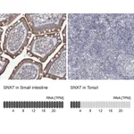 Atlas Antibodies Anti-SNX7 Antibody