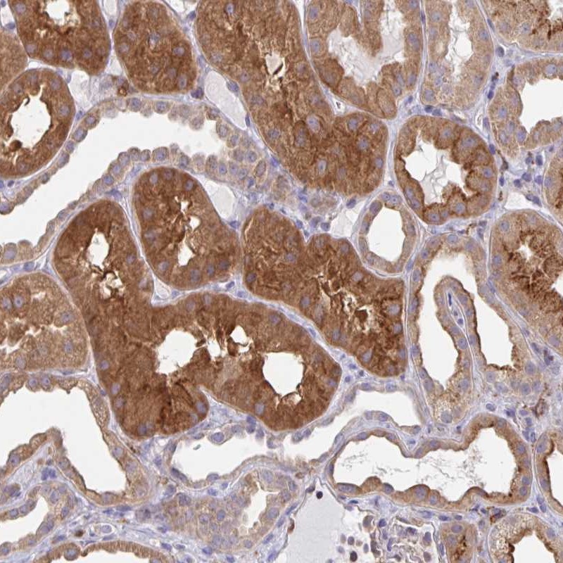 Atlas Antibodies Anti-SNX8 Antibody