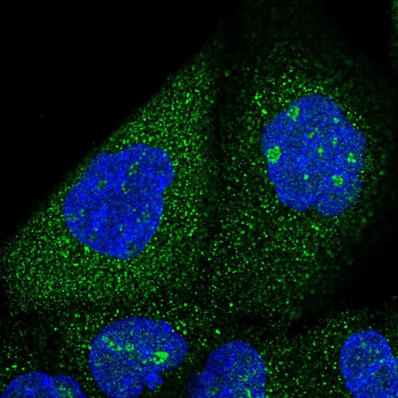 Atlas Antibodies Anti-SNX7 Antibody