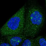 Atlas Antibodies Anti-SNX7 Antibody