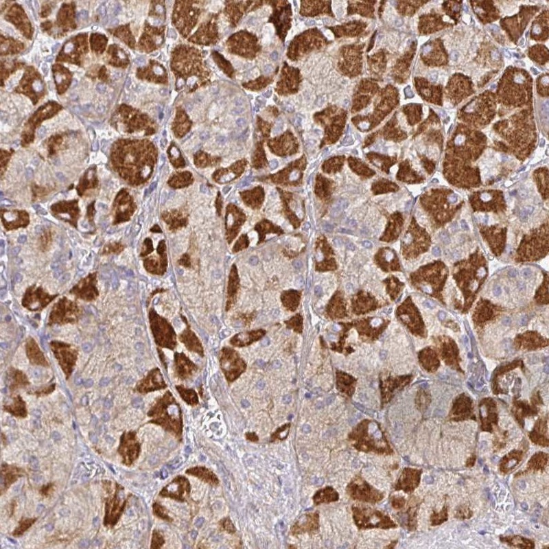 Atlas Antibodies Anti-SNX8 Antibody