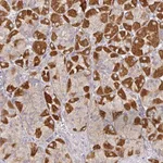Atlas Antibodies Anti-SNX8 Antibody