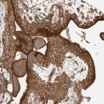 Atlas Antibodies Anti-SNX9 Antibody