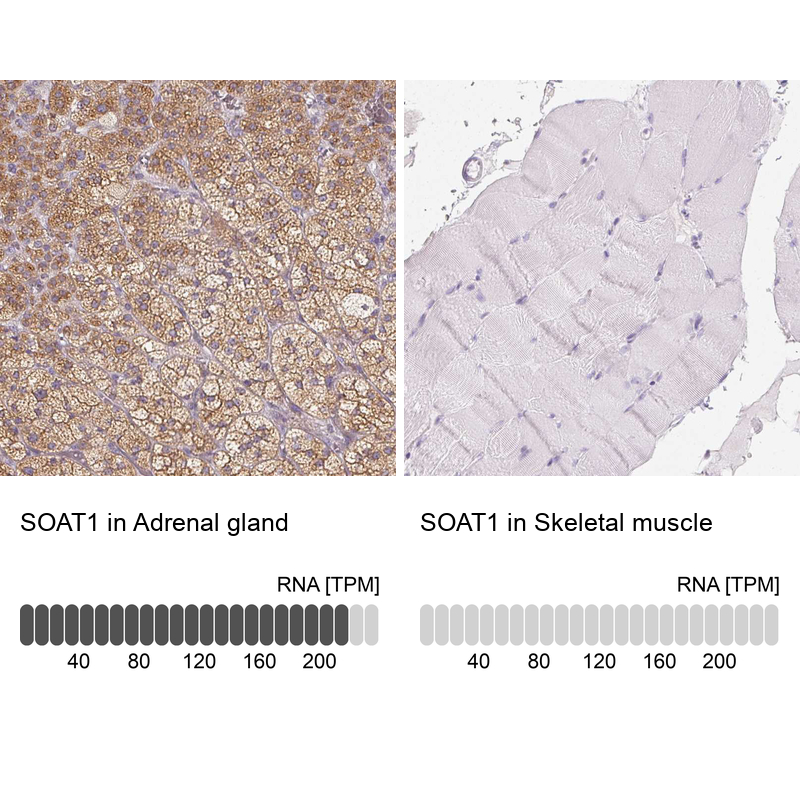 Atlas Antibodies Anti-SOAT1 Antibody