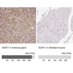Atlas Antibodies Anti-SOAT1 Antibody