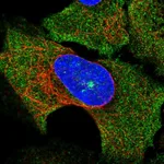 Atlas Antibodies Anti-SOCS3 Antibody