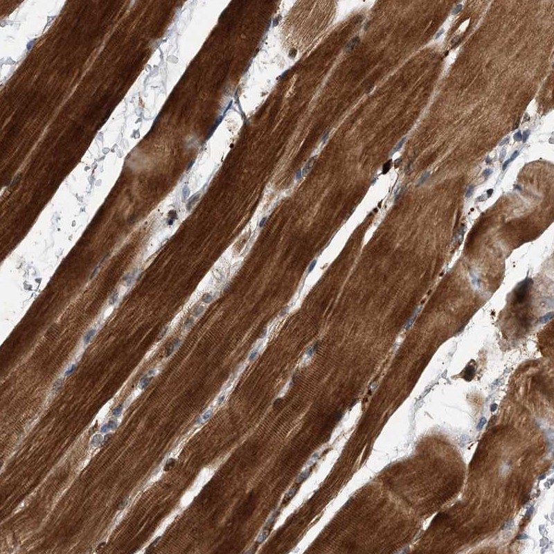 Atlas Antibodies Anti-SOBP Antibody