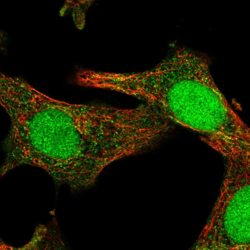 Atlas Antibodies Anti-SOCS4 Antibody