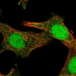 Atlas Antibodies Anti-SOCS4 Antibody