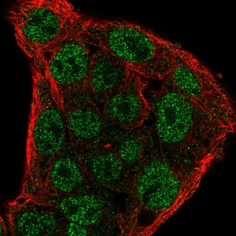 Atlas Antibodies Anti-SOCS1 Antibody