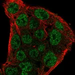 Atlas Antibodies Anti-SOCS1 Antibody