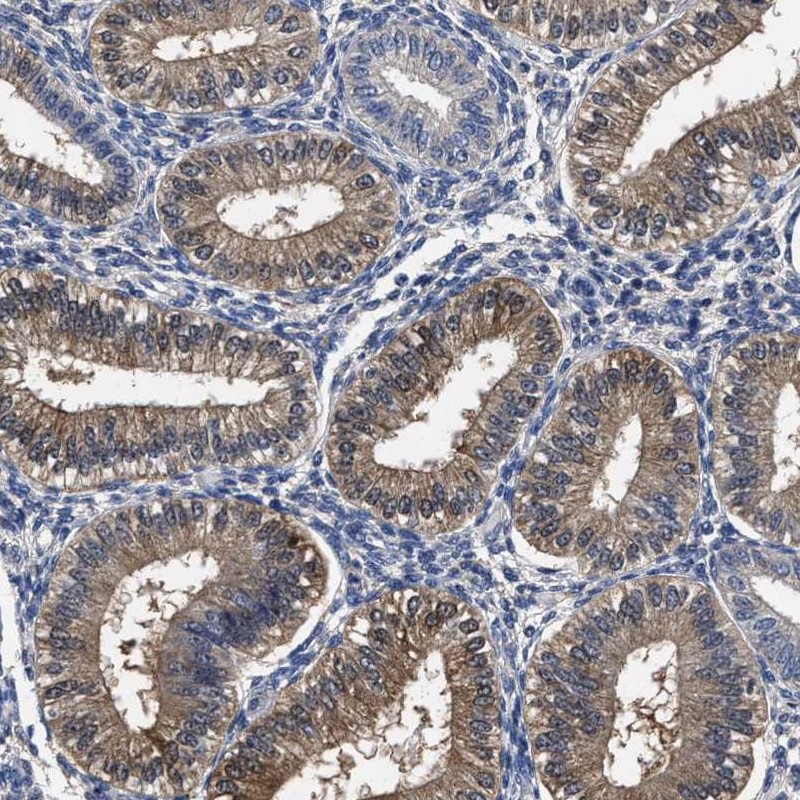 Atlas Antibodies Anti-SOCS5 Antibody