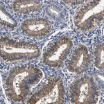 Atlas Antibodies Anti-SOCS5 Antibody