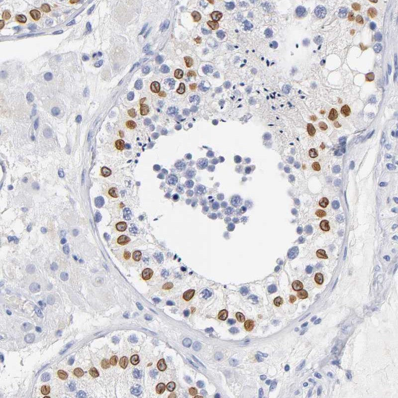 Atlas Antibodies Anti-SOCS7 Antibody