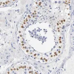 Atlas Antibodies Anti-SOCS7 Antibody