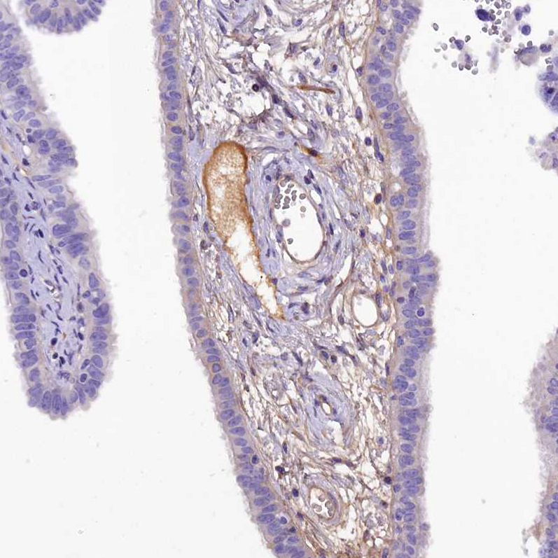 Atlas Antibodies Anti-SOD3 Antibody