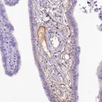 Atlas Antibodies Anti-SOD3 Antibody
