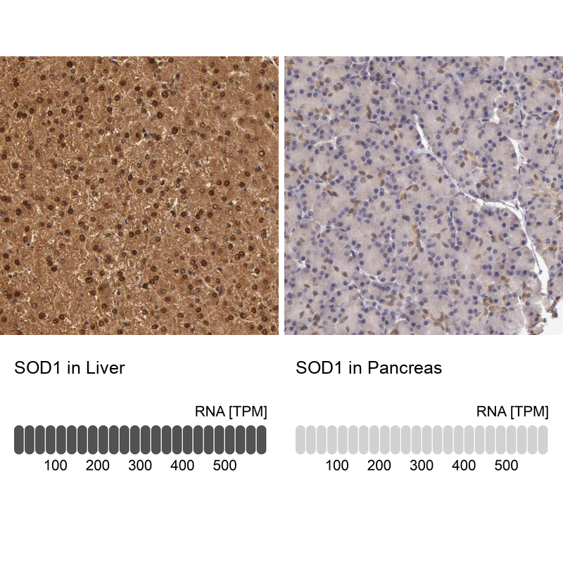 Atlas Antibodies Anti-SOD1 Antibody