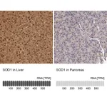 Atlas Antibodies Anti-SOD1 Antibody