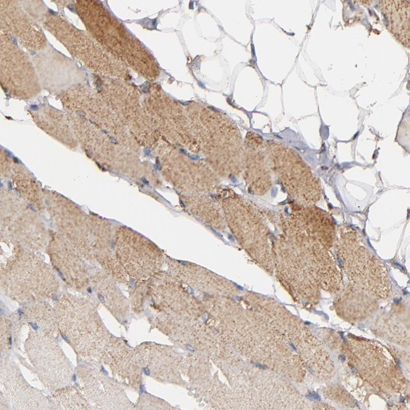 Atlas Antibodies Anti-SOD2 Antibody