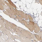 Atlas Antibodies Anti-SOD2 Antibody