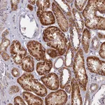Atlas Antibodies Anti-SOGA1 Antibody