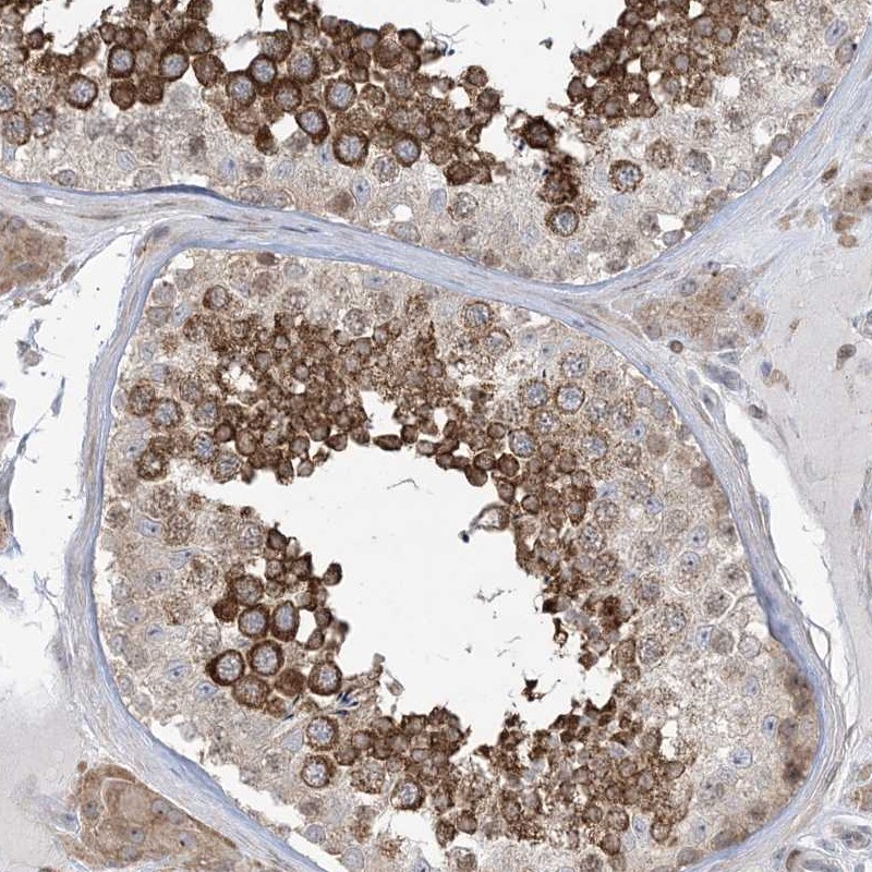 Atlas Antibodies Anti-SOGA3 Antibody