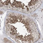 Atlas Antibodies Anti-SOGA3 Antibody