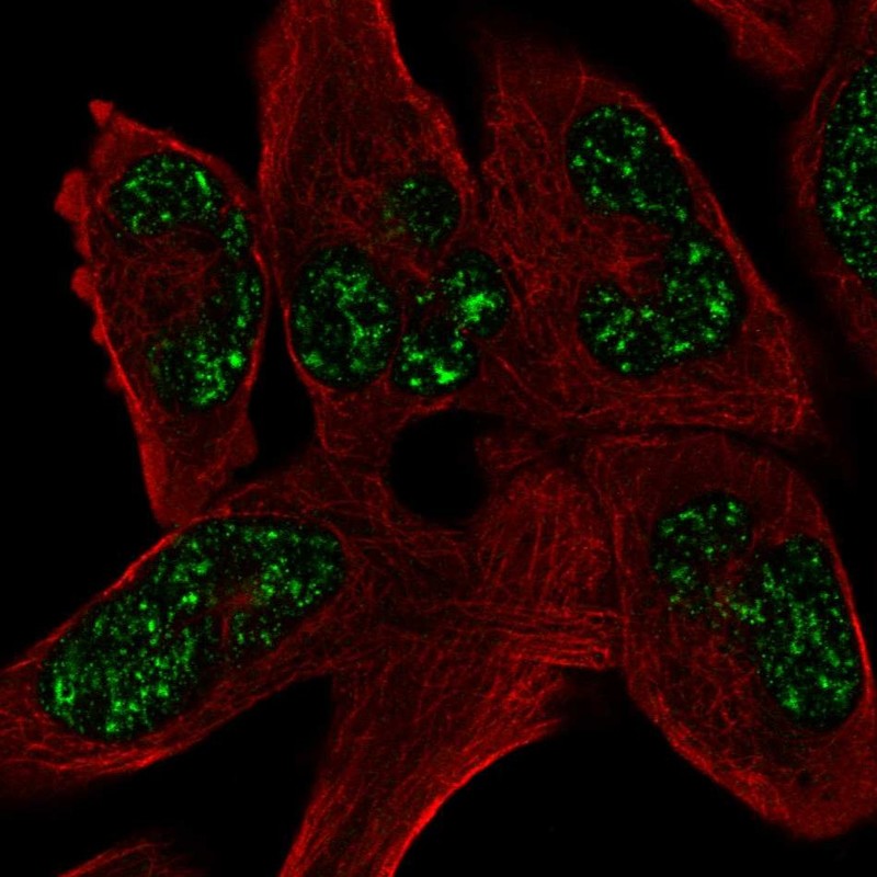 Atlas Antibodies Anti-SOHLH1 Antibody