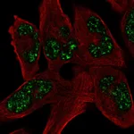 Atlas Antibodies Anti-SOHLH1 Antibody