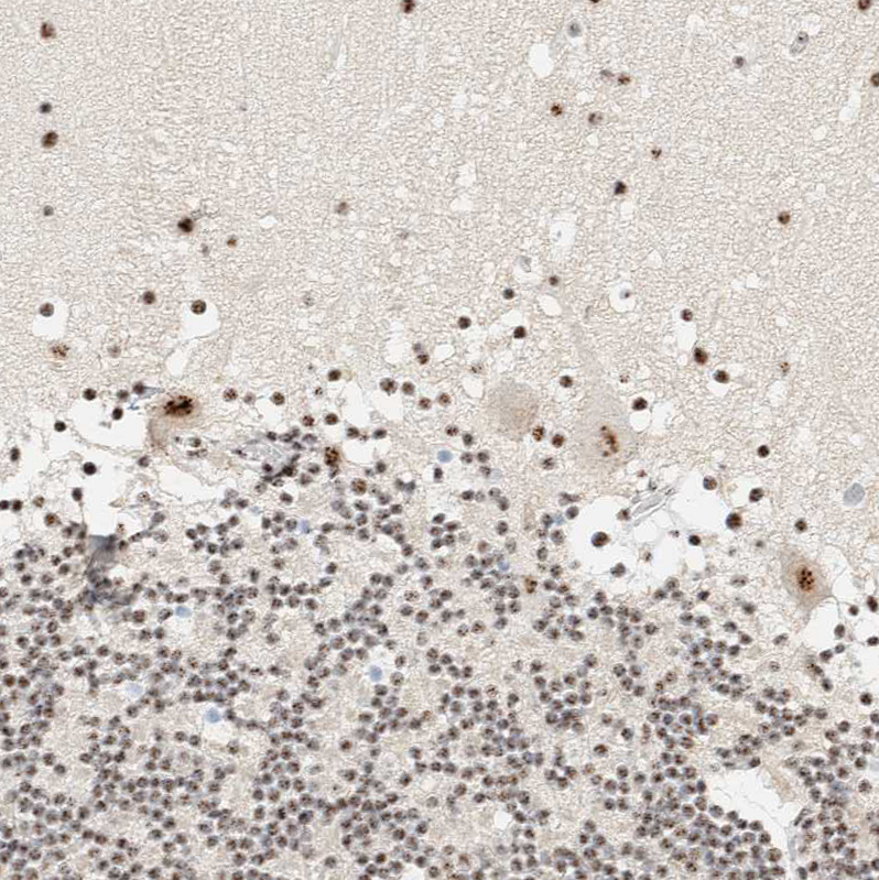 Atlas Antibodies Anti-SON Antibody